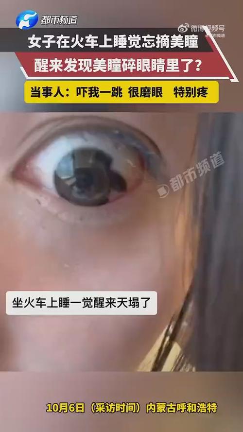 如果出门发现忘了带美瞳的盒子、晚上睡觉怎么「睡觉忘摘美瞳碎眼里了」 小牛电动车